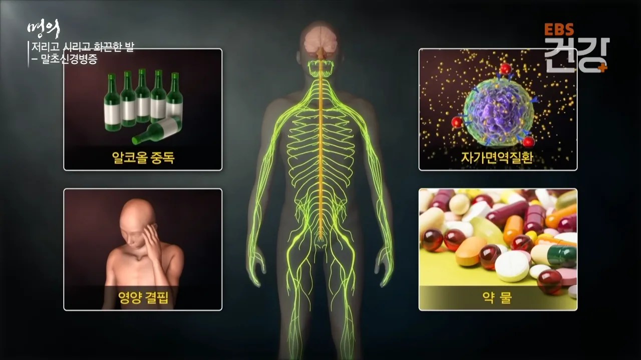 周围神经病变的病因