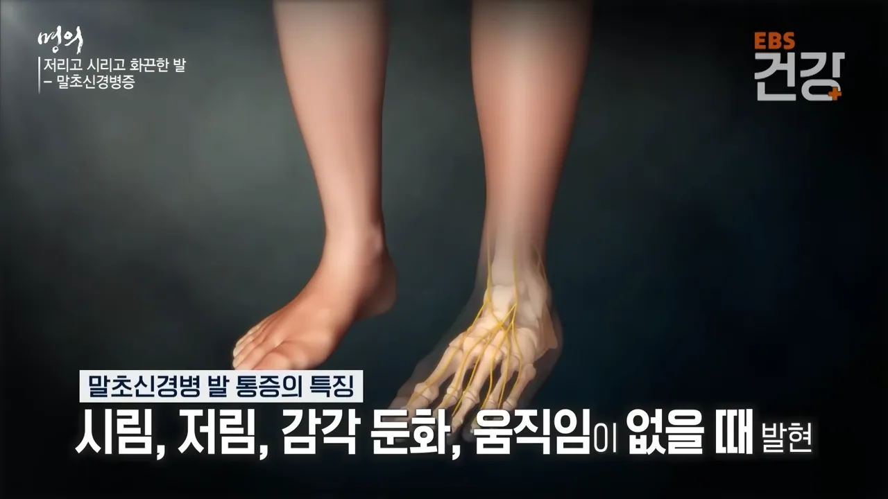 足部疼痛的特点